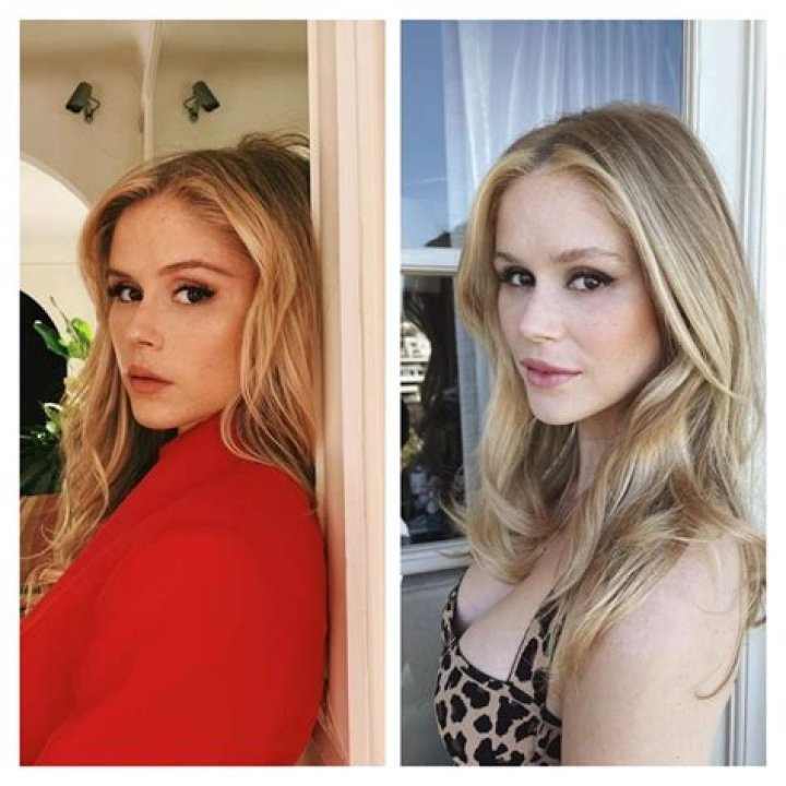 Erin Moriarty Before And After Plastic Surgery Her Transformation Journey