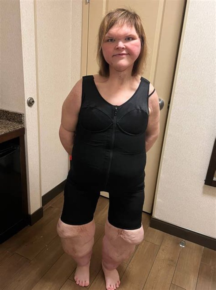 Why Is Tammy Slaton's Forehead Attracting Attention? '1000Lb Sisters